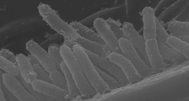 Cellule del batterio Xylella fastidiosa colonizzano un insetto