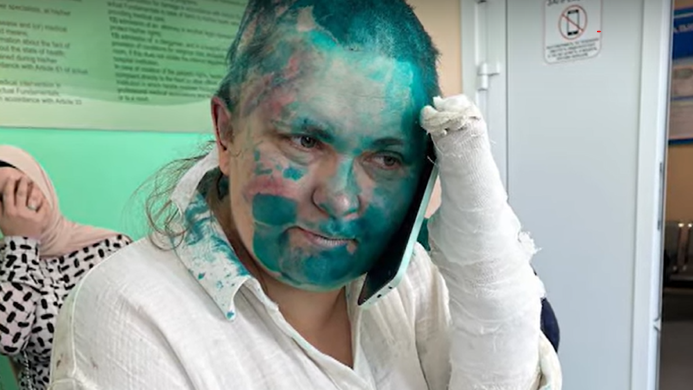 Elena Milashina seduta sul letto di un ospedale. La mano sinistra è fasciata e appoggiata al volto. Il visto e la testa sono colorati di blu per via del disinfettante.